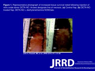 John A. Russell, MS; et al. JRRD 2010; 47.1: 61-66