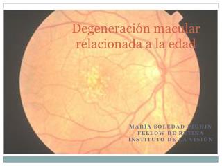 Degeneración macular relacionada a la edad