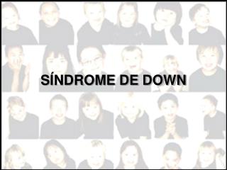 SÍNDROME DE DOWN