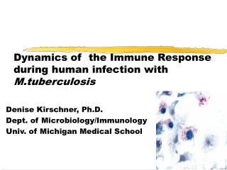 Dynamics of the Immune Response during human infection with M.tuberculosis