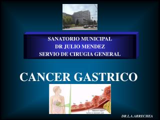 CANCER GASTRICO