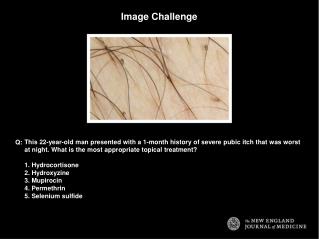 Image Challenge