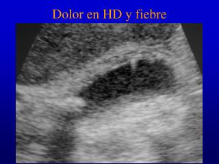 Dolor en HD y fiebre