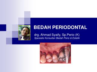 BEDAH PERIODONTAL