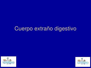 Cuerpo extraño digestivo