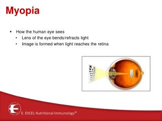 Myopia