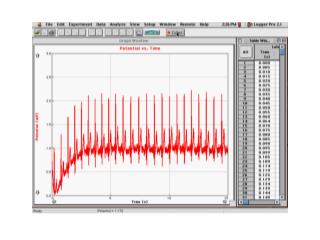 Matt’s EKG Readings