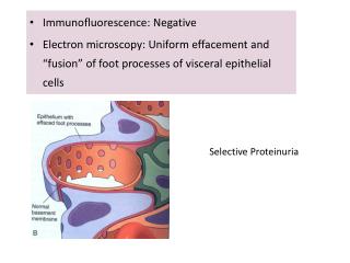 Immunofluorescence: Negative