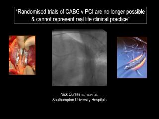 “Randomised trials of CABG v PCI are no longer possible