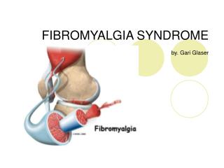 FIBROMYALGIA SYNDROME by. Gari Glaser