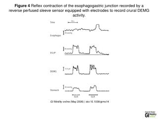 GI Motility online (May 2006) | doi:10.1038/gimo14