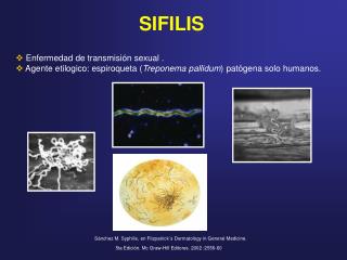 SIFILIS