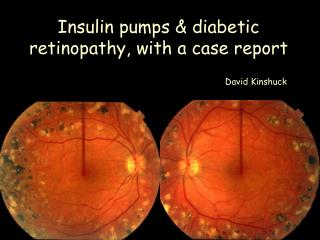 Insulin pumps & diabetic retinopathy, with a case report