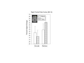 Right Frontal Polar Cortex (BA 10)
