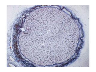 optic nerve