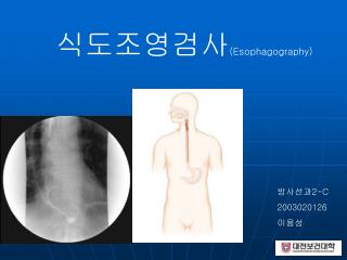 식도조영검사 (Esophagography)