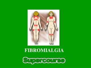 FIBROMIALGIA