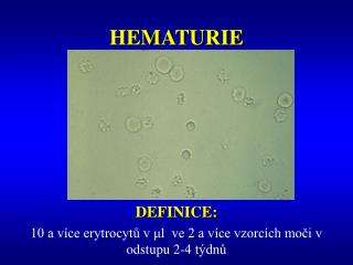 HEMATURIE