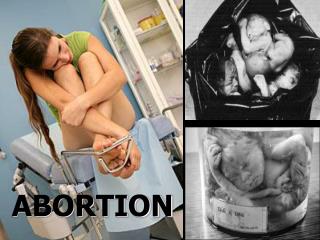 ABORTION
