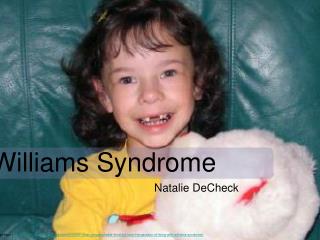 Williams Syndrome