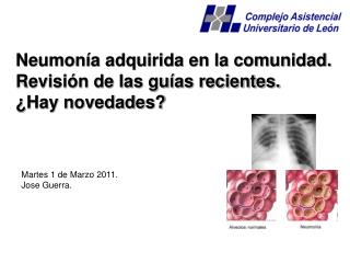 Neumonía adquirida en la comunidad. Revisión de las guías recientes. ¿Hay novedades?