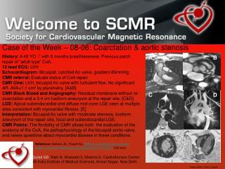 Case of the Week – 08-06: Coarctation &amp; aortic stenosis