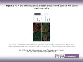 Figure 3 PCR and immunostaining of tissue biopsies from patients with stress cardiomyopathy