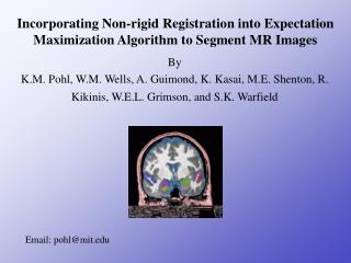 Incorporating Non-rigid Registration into Expectation Maximization Algorithm to Segment MR Images