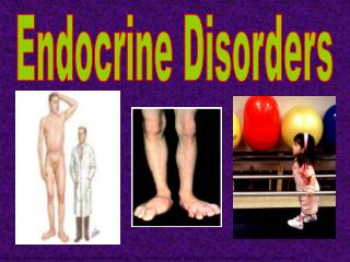 Endocrine Disorders