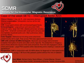 Case of the week 08:10 – Interrupted Aortic Arch