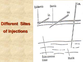 Different Sites of Injections
