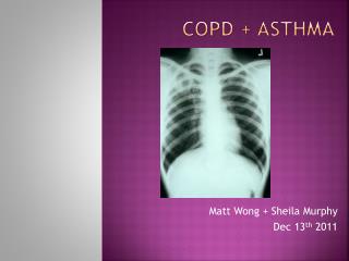 COPD + ASTHMA