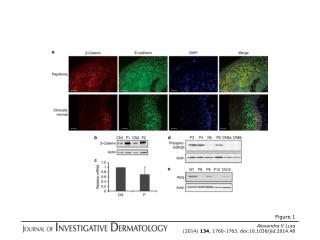 Alexandra V Lucs (2014) 134 , 1760-1763. doi:10.1038/jid.2014.48