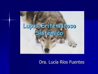 Lupus Eritematoso Sistémico