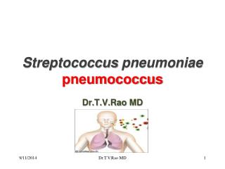 Streptococcus pneumoniae pneumococcus
