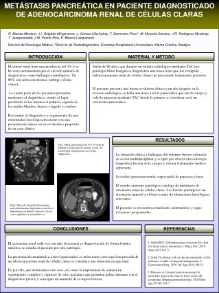 METÁSTASIS PANCREÁTICA EN PACIENTE DIAGNOSTICADO DE ADENOCARCINOMA RENAL DE CÉLULAS CLARAS