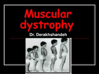 Muscular dystrophy