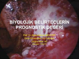 BİYOLOJİK BELİRTEÇLERİN PROGNOSTİK DEĞERİ