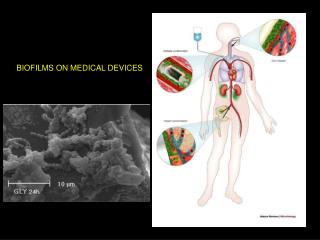 BIOFILMS ON MEDICAL DEVICES