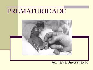 PREMATURIDADE