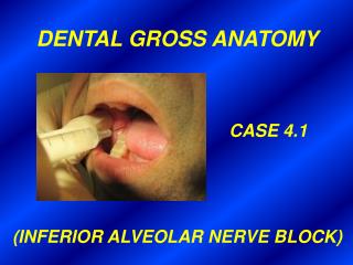 DENTAL GROSS ANATOMY 						 CASE 4.1 (INFERIOR ALVEOLAR NERVE BLOCK)