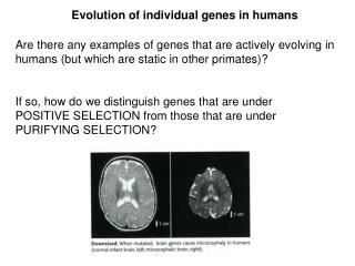 Evolution of individual genes in humans