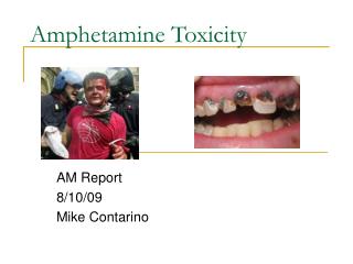 Amphetamine Toxicity