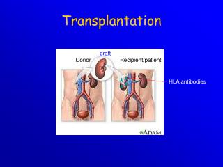 Transplantation