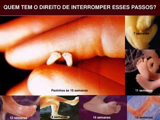 QUEM TEM O DIREITO DE INTERROMPER ESSES PASSOS?
