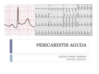 PERICARDITIS AGUDA