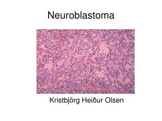 Neuroblastoma