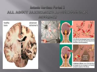 Antonio Martinez Period 3 ALL ABOUT ALZHEIMER'S A Psychological Disorder