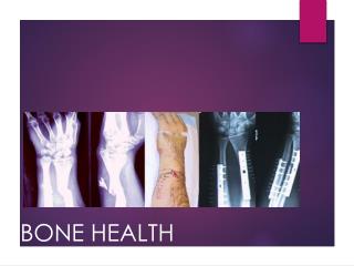BONE HEALTH