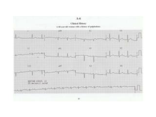 Practice-12-Lead-ECGs